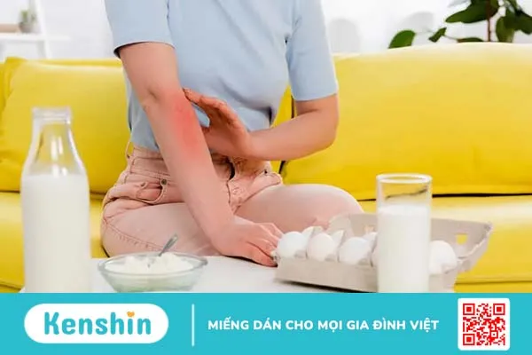 Dị ứng trứng gà: Nguyên nhân, triệu chứng và cách phòng ngừa