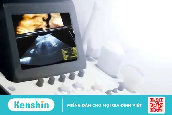 Điểm danh 15 phòng khám siêu âm 4D uy tín tại TPHCM