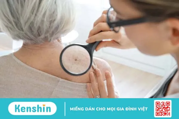 Điểm danh 7 loại ung thư có khả năng chữa khỏi