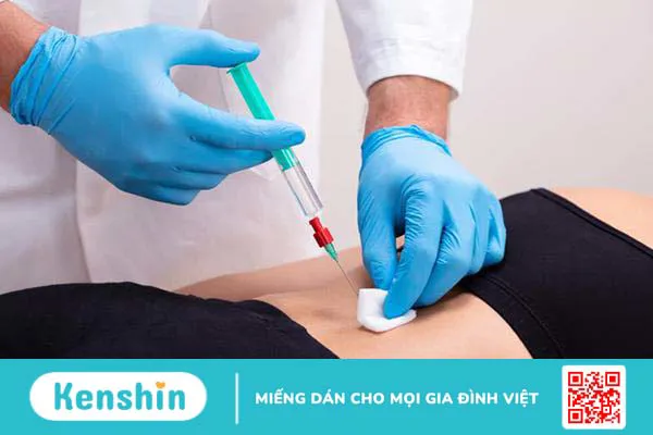 Điểm danh các nhóm thuốc điều trị viêm cột sống dính khớp