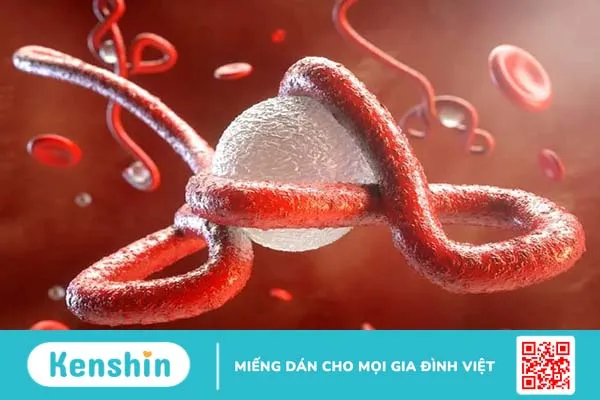 Điểm danh top 10+ virus nguy hiểm nhất mọi thời đại trên toàn cầu