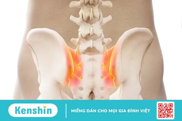 “Điểm mặt” 8 nguyên nhân gây bệnh đau lưng chủ yếu ở phụ nữ