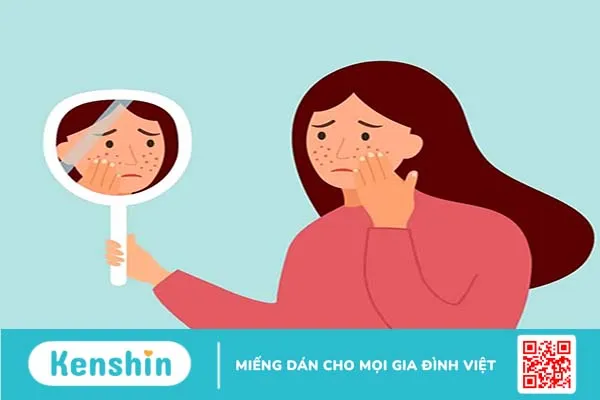 “Điểm tên” các loại thuốc chữa buồng trứng đa nang thông dụng