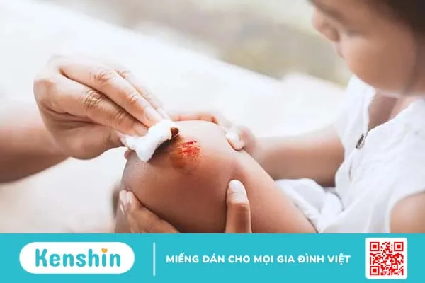 Điều trị giảm tiểu cầu miễn dịch như thế nào? Làm sao để tối ưu hiệu quả điều trị?