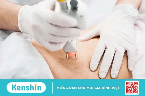 Điều trị rạn da: 8 phương pháp trị rạn da phổ biến