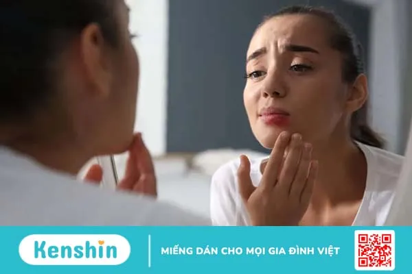 Điều trị sẹo ở môi do Herpes, mụn rộp môi, mụn nước: Cần làm thế nào?