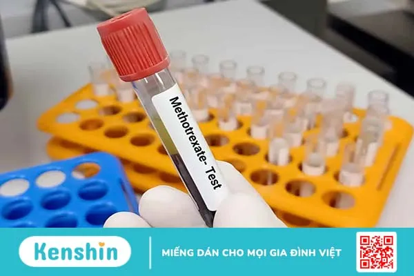 Điều trị thai ngoài tử cung bằng thuốc bao lâu thì thai ra? Mẹ cần lưu ý gì?