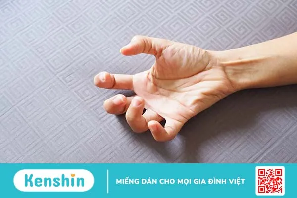 Điều trị và chăm sóc bệnh nhân sau tai biến bị co giật