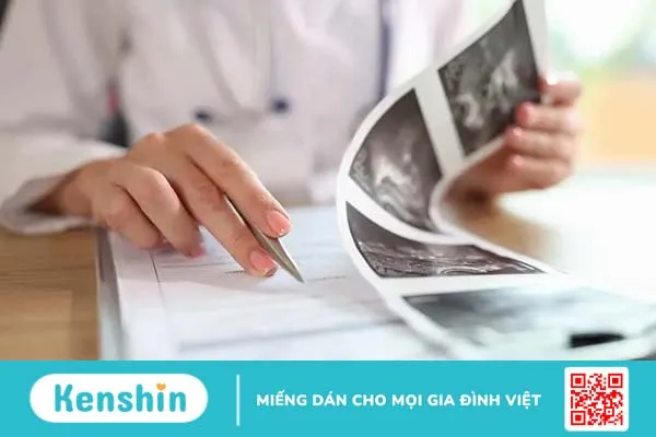 Dính buồng tử cung (hội chứng Asherman) là gì và có chữa được không?