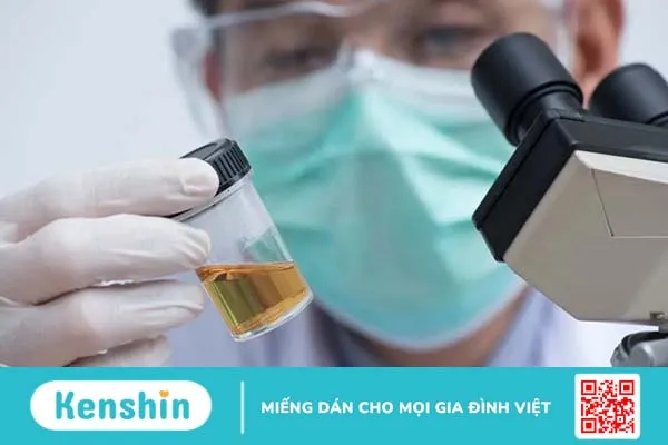 Định lượng protein niệu