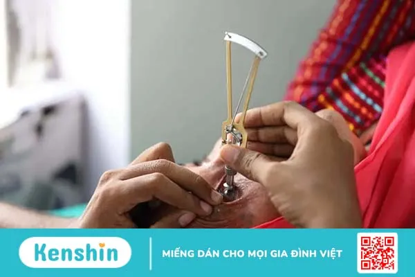 Đo nhãn áp là gì? Những ai cần tiến hành đo nhãn áp?