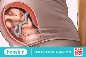 Đưa bé vào ngôi thai thuận trước sinh giúp mẹ sinh con dễ dàng