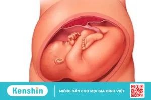 Đưa bé vào ngôi thai thuận trước sinh giúp mẹ sinh con dễ dàng