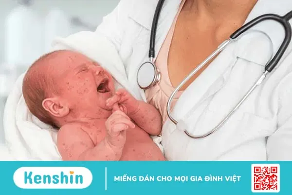 Dựa trên triệu chứng để phân biệt sởi và rubella