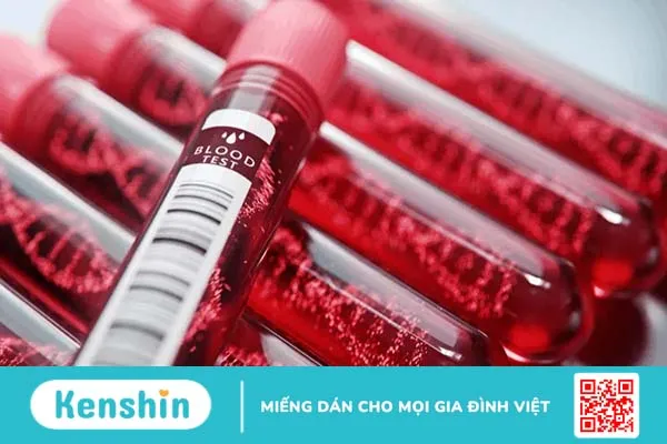 Đừng xem nhẹ viêm amidan ở người lớn