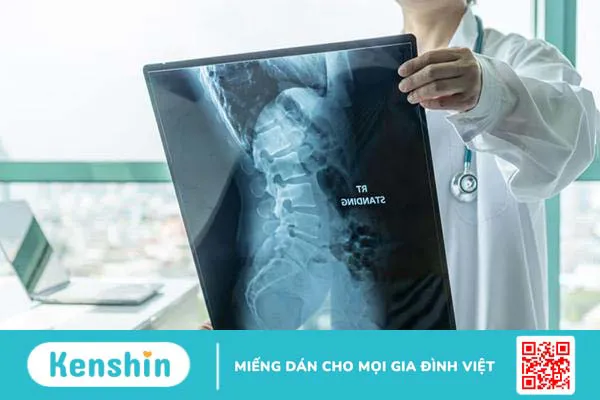 Gai đôi cột sống bẩm sinh