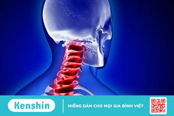 Gãy xương cổ là gì ? Triệu chứng và nguyên nhân