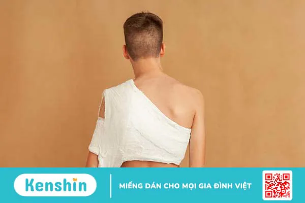 Gãy xương đòn đeo đai số 8 bao lâu thì lành?