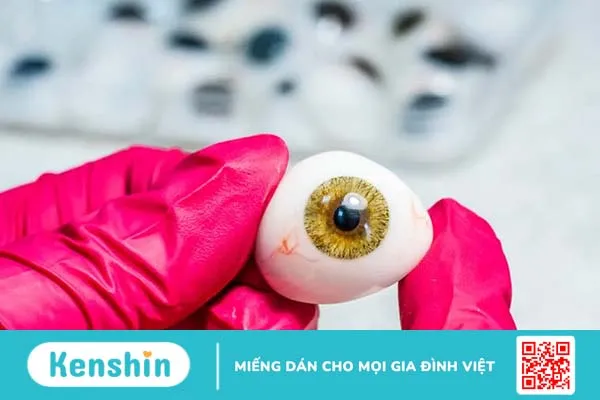 Ghép giác mạc và những điều có thể bạn chưa biết