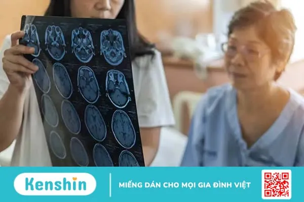 Giải đáp cho thắc mắc người bị tai biến sống được bao lâu?