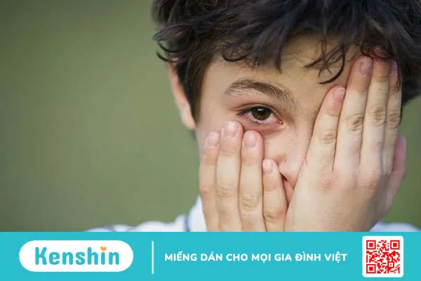 Giải đáp: Đau mắt đỏ ở trẻ em bao lâu thì khỏi? Khi nào cần đưa bé đi khám?