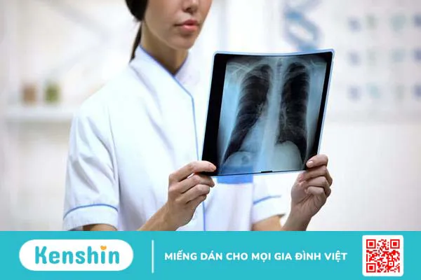 Giải đáp lao hạch có tái phát không?