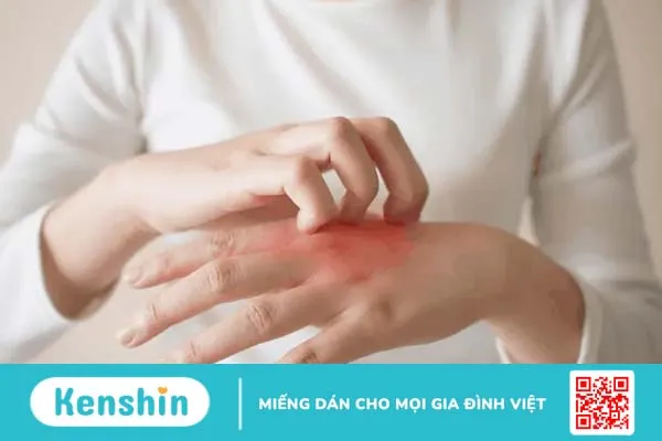 Giải đáp thắc mắc: Bị nổi mẩn do dị ứng amoxicillin cần làm gì?