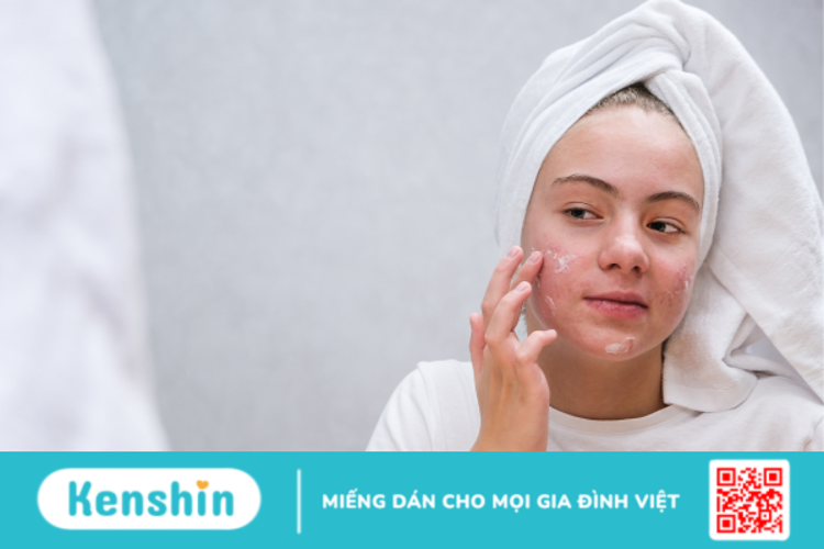 Giải đáp thắc mắc: Mụn tuổi dậy thì có tự hết không?