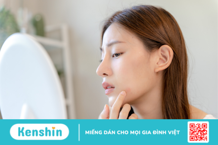 Giải đáp thắc mắc: Mụn tuổi dậy thì có tự hết không?