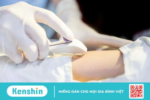 Giải đáp thắc mắc: Sau sinh bao lâu thì cấy que tránh thai được?