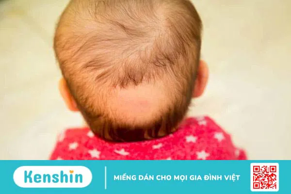 Giải đáp: Trẻ bị rụng tóc là thiếu chất gì và cách khắc phục ra sao?