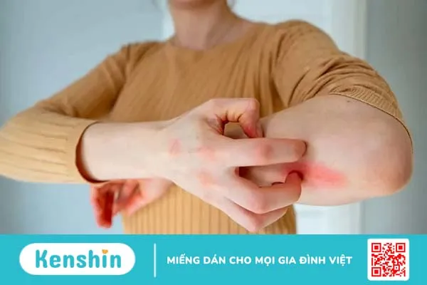 Giải đáp từ chuyên gia: Dị ứng thuốc bao lâu thì khỏi, điều trị như thế nào?