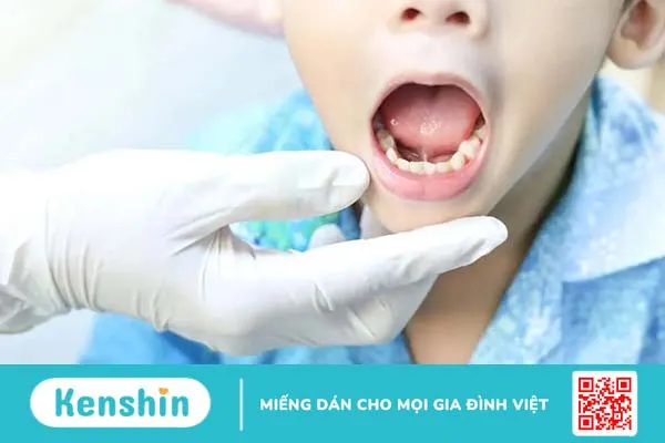 “Giải mã” những nguyên nhân khiến trẻ 3 tuổi chưa biết nói