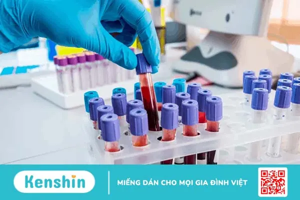 Giải thích chi tiết kết quả xét nghiệm rubella IgM và IgG