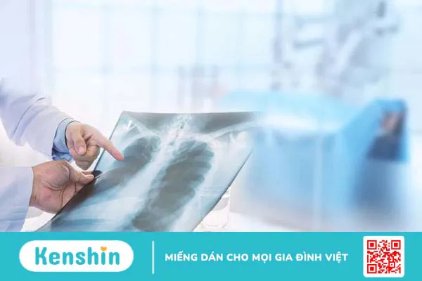 Giãn phế nang có nguy hiểm không và liệu có điều trị được?