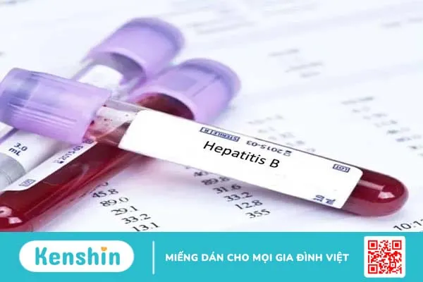 Giúp bạn giải đáp 10 thắc mắc về viêm gan siêu vi B