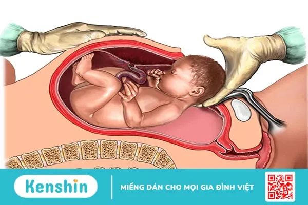 “Gỡ rối” 13 quan niệm sai lầm khi mang thai phổ biến nhất