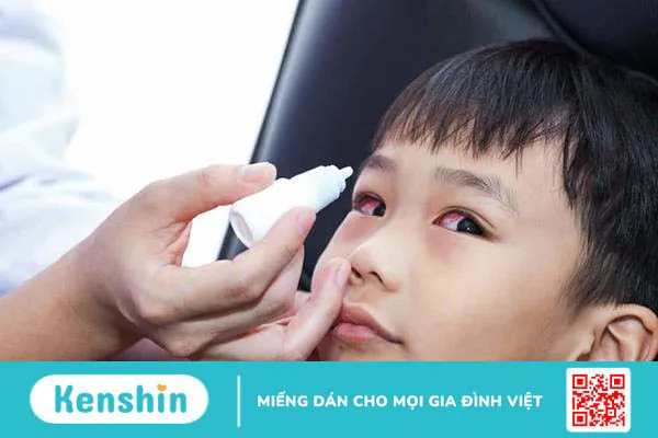 Góc giải đáp: Trẻ nhìn vào mắt người đau mắt đỏ có bị lây không?