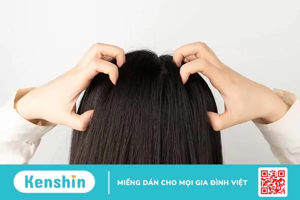 Gợi ý 5 dầu gội trị nấm da đầu dễ tìm mua tại nhà thuốc