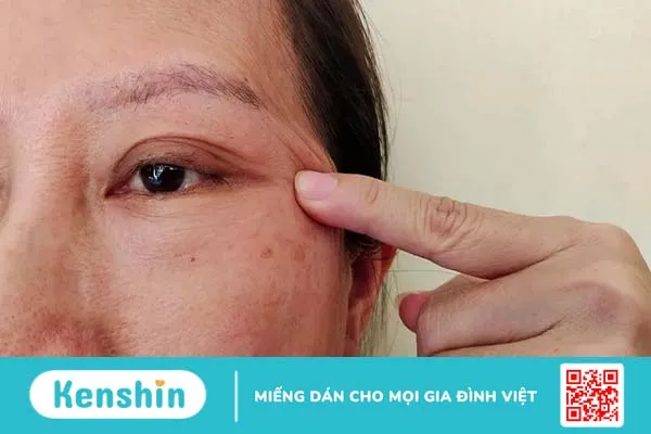 Hậu quả nghiêm trọng nhất của bệnh đau mắt hột & Cách phòng ngừa