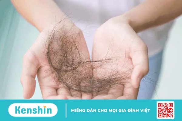 Hậu sản là gì? Tìm hiểu chi tiết 13 vấn đề sau sinh thường gặp