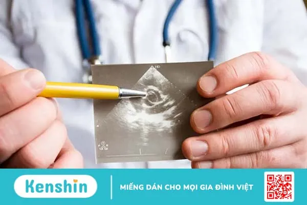 Hẹp van động mạch chủ