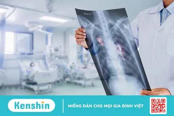 Hiểu đúng hơn về triệu chứng, nguyên nhân và cách trị khó thở