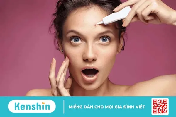 Hiểu rõ về các loại mụn để có cách điều trị đúng