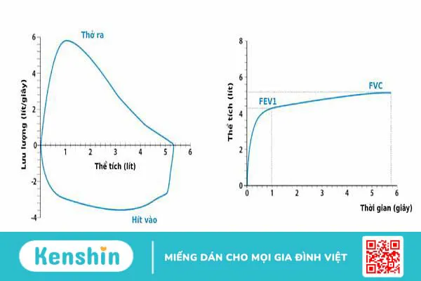 Hô hấp ký - Phương pháp thăm dò chức năng hô hấp quan trọng