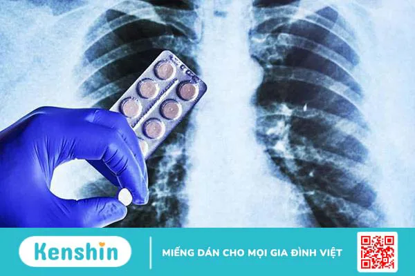 Hội chứng đông đặc phổi là gì? Nguyên nhân, dấu hiệu và cách điều trị