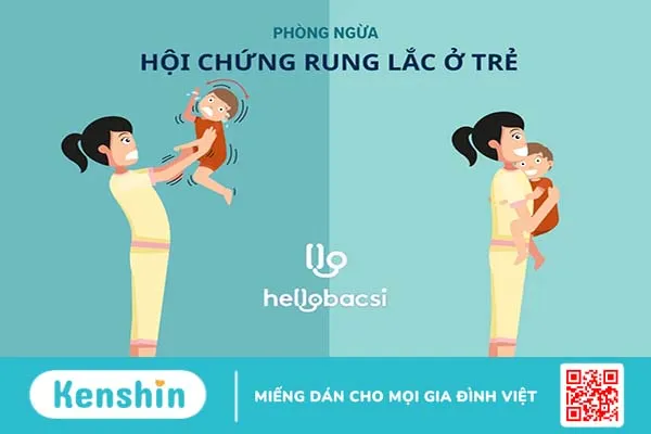 Hội chứng rung lắc ở trẻ nguy hiểm ra sao? Dấu hiệu, nguyên nhân, cách sơ cứu