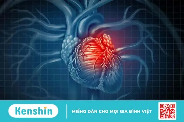 Hội chứng vành cấp