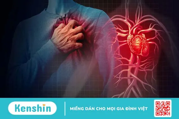 Hội chứng Wellen – Dấu hiệu cảnh báo nhồi máu cơ tim cấp