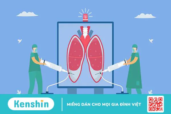 Hỏi đáp bác sĩ: Điều trị tràn dịch màng phổi bao lâu?